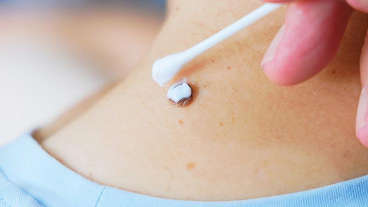 lazerle aldiran da var solusyon suren de her ben masum degil incelenmeli O66Pey1U.jpg